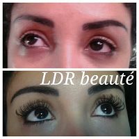 Ldr beaut31000Toulouse