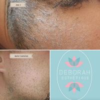 DEBORAH ESTHTIQUE40300Peyrehorade