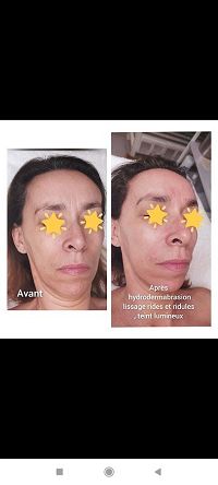 Estelle esthtique42390Villars
