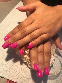 prothsiste ongulaire27200Vernon